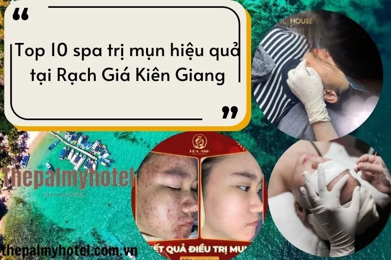 Top 10 spa trị mụn hiệu quả tại Rạch Giá Kiên Giang